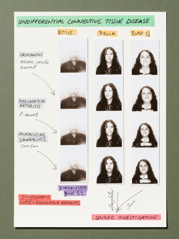 Jenny Lewis Autoportraits Undifferentiated soft tissue disease
Rosy, Della, Buddy