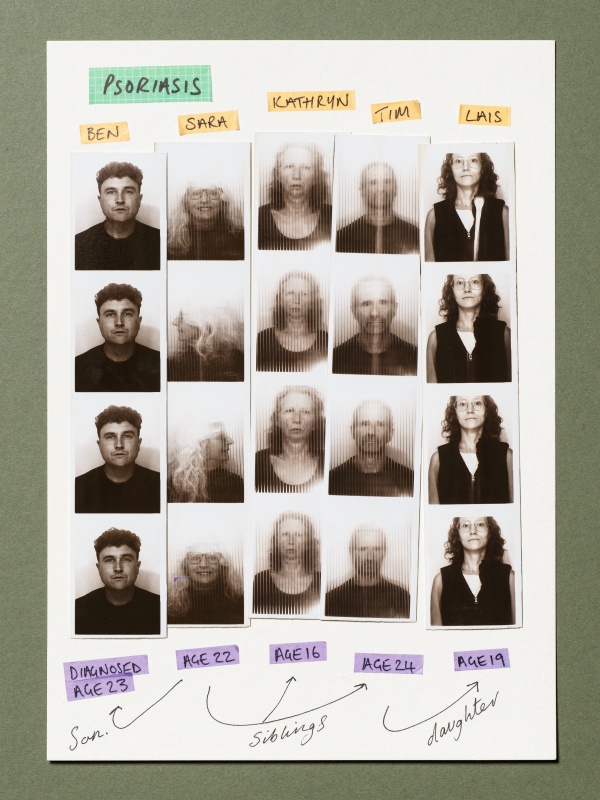 Jenny Lewis Autoportraits Psoriasis :
Ben, Sarah, Kathryn, Tim, Láis